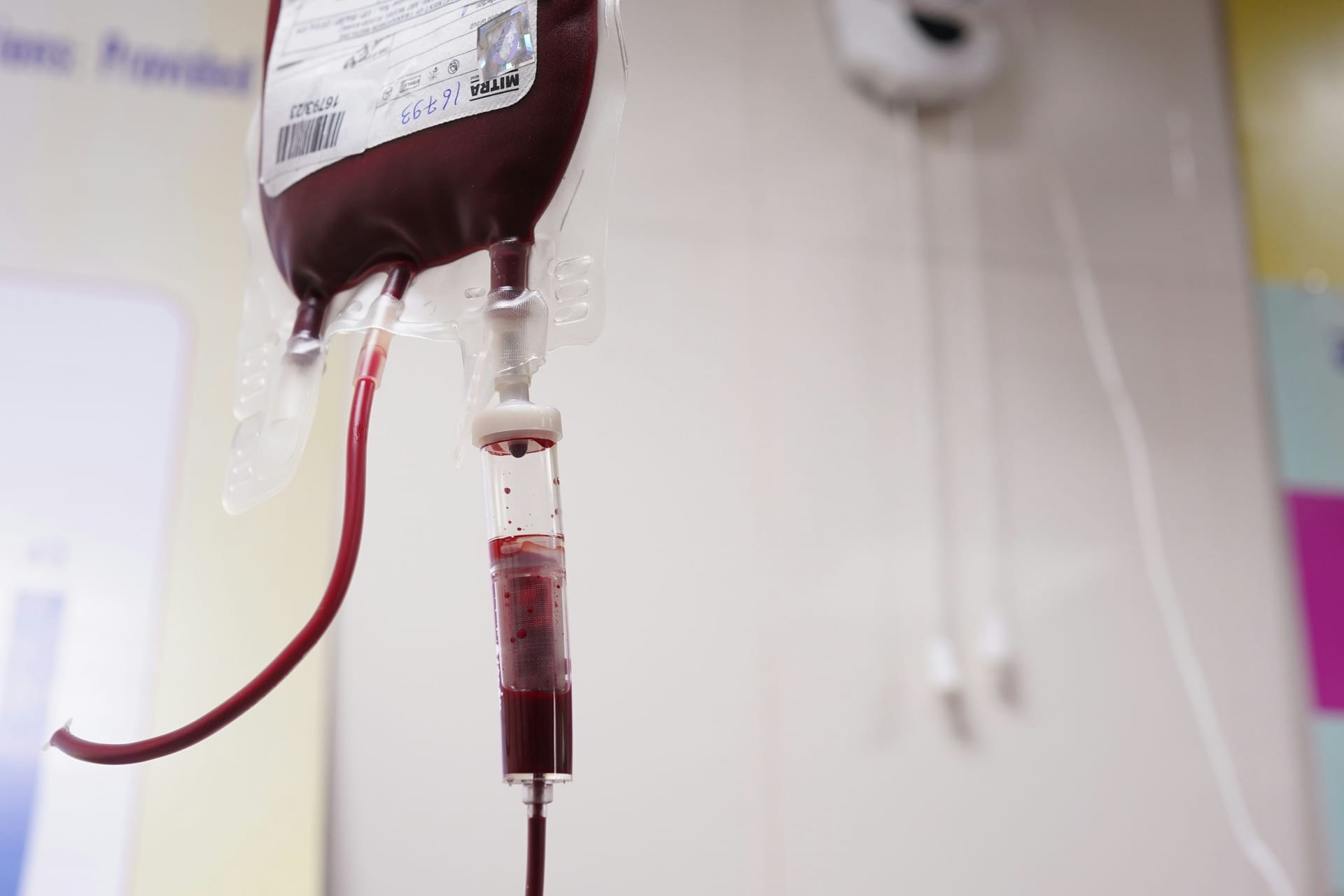 Una bolsa de sangre colgada con su tubo y una cámara de goteo, frente a una pared clara desenfocada.