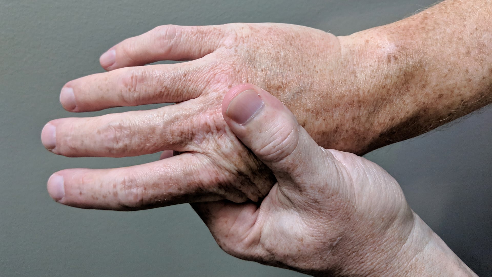 Una persona se sujeta y masajea una mano con la otra, con los dedos algo deformes en las articulaciones, sobre un fondo claro.