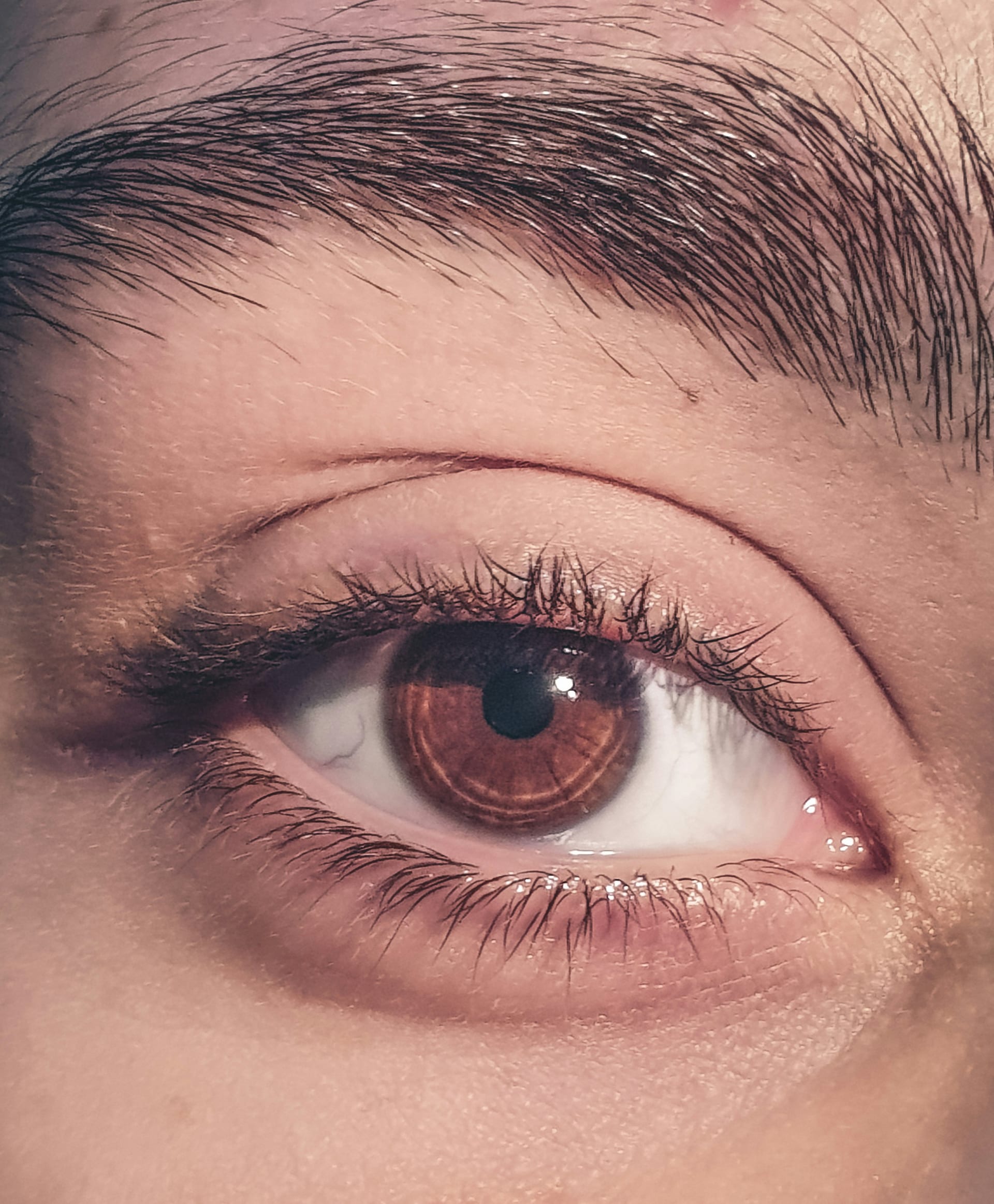 Primer plano de un ojo color café completamente abierto, con pestañas oscuras y sin enrojecimiento visible.