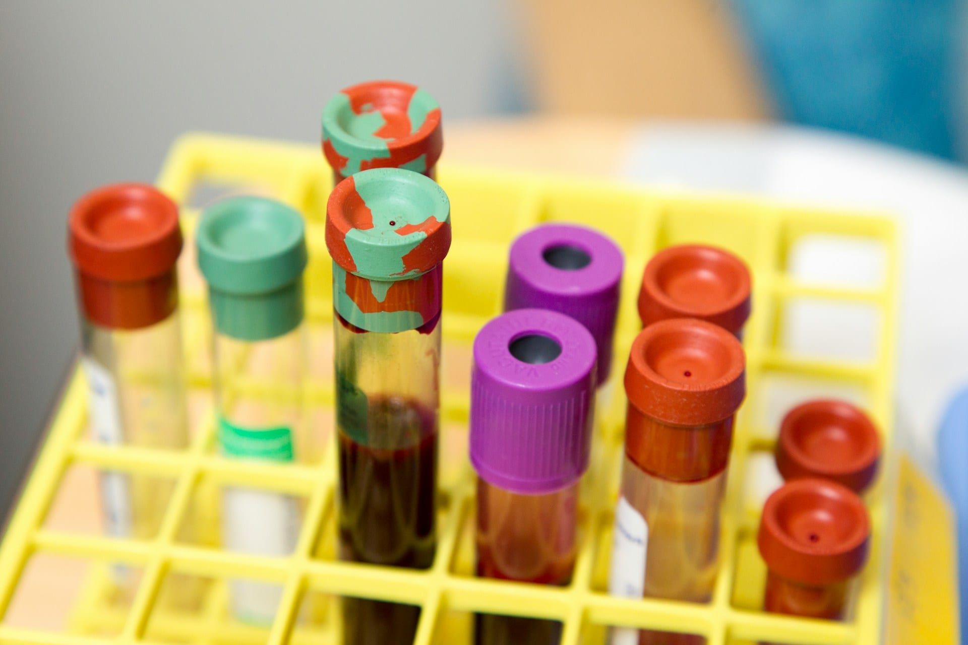 Tubos de ensayo con muestras de sangre y tapones rojos, verdes y morados en una gradilla amarilla.