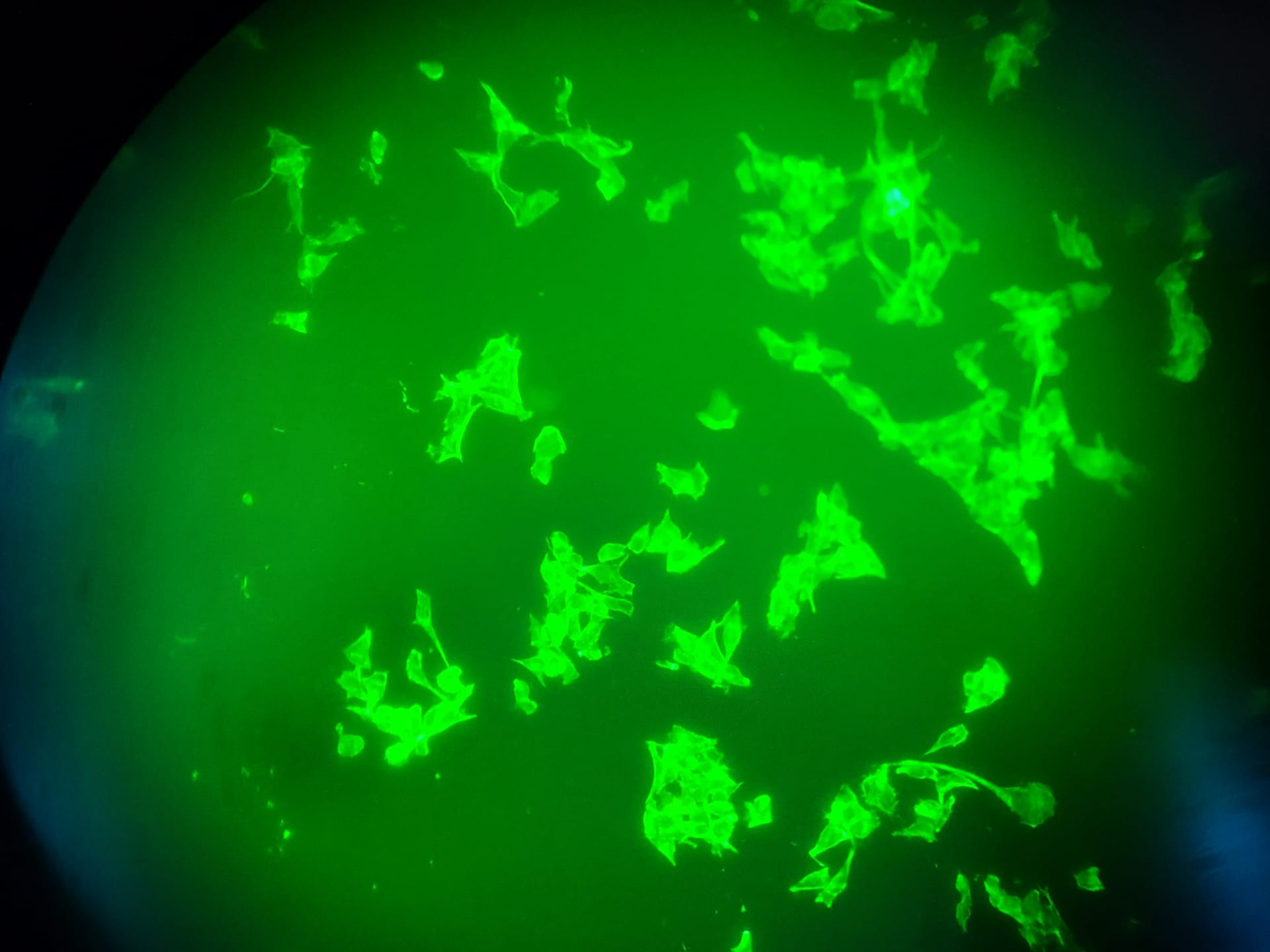 Células teñidas con fluorescencia verde brillante, de formas irregulares, sobre un fondo oscuro visto por el ocular de un microscopio.