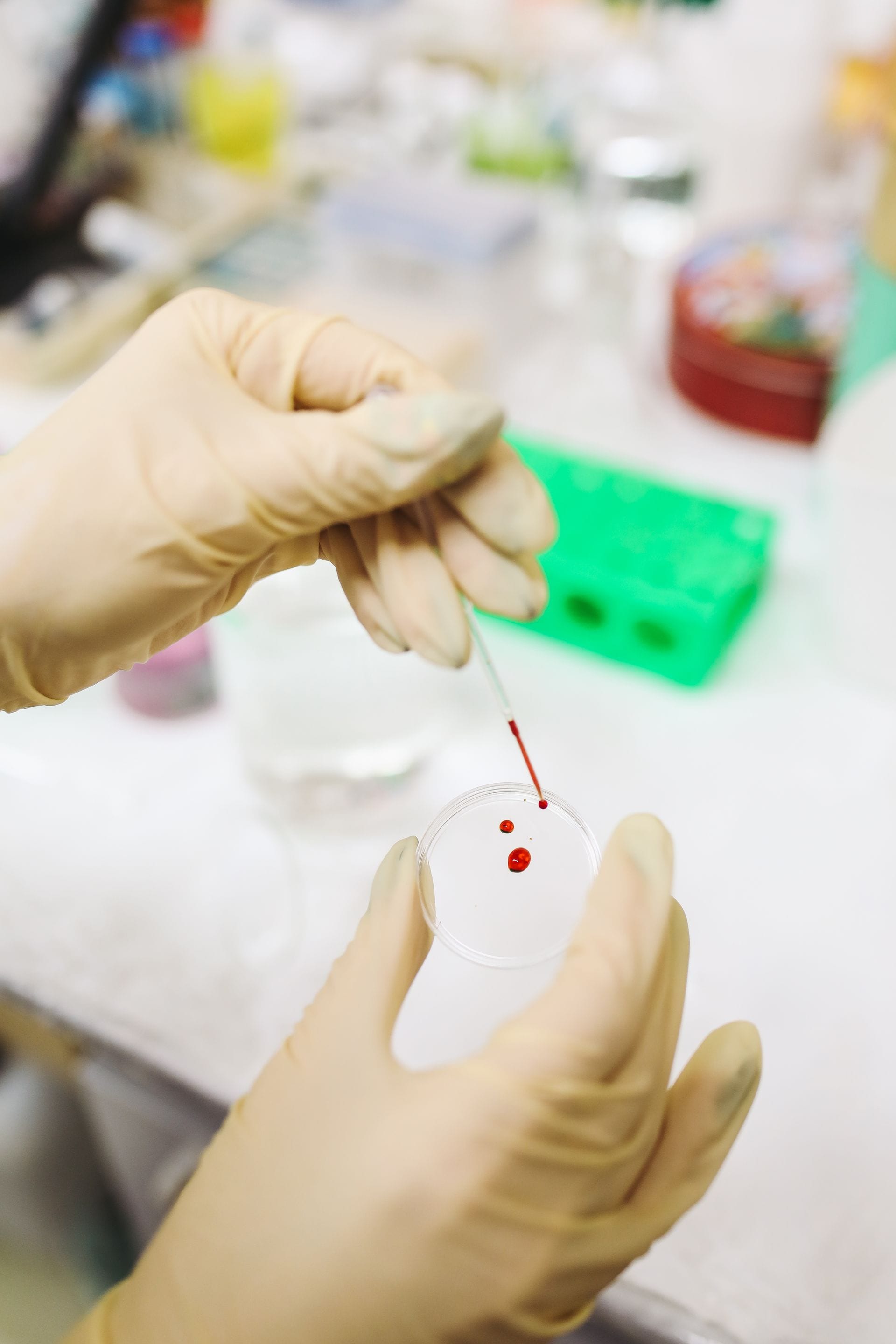 Unas manos con guantes de látex dejan caer con una pipeta gotas de sangre en una caja de Petri transparente.